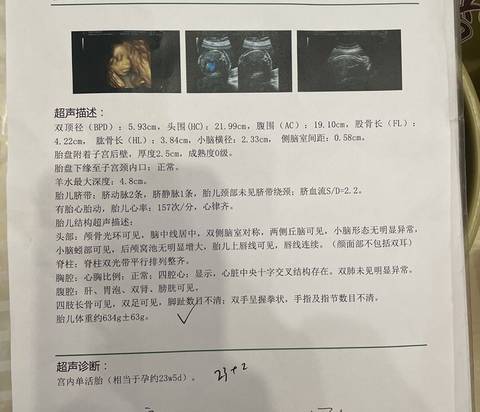 journal_insert_pic_1741047629