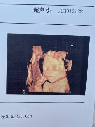 journal_insert_pic_1676859234