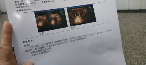 journal_insert_pic_1684605254