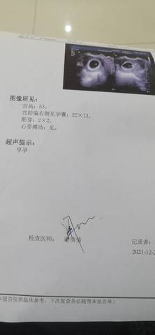 journal_insert_pic_1683222180