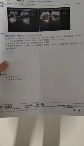 journal_insert_pic_1675376363