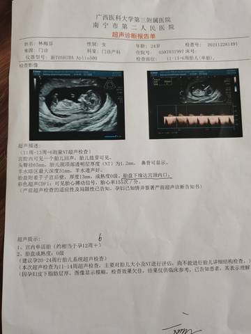 journal_insert_pic_1687856688