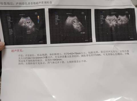 journal_insert_pic_1686689232