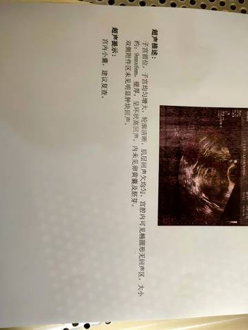 journal_insert_pic_1685765149