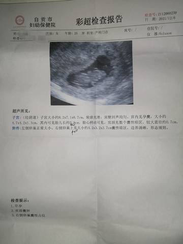 journal_insert_pic_1675060841