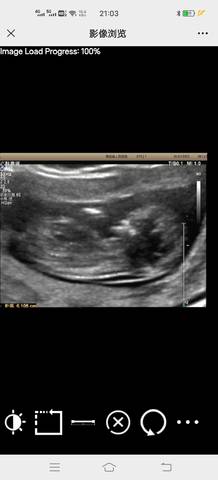 journal_insert_pic_1719798795