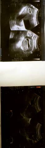 journal_insert_pic_1677608927