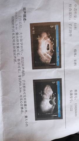 journal_insert_pic_1683098790