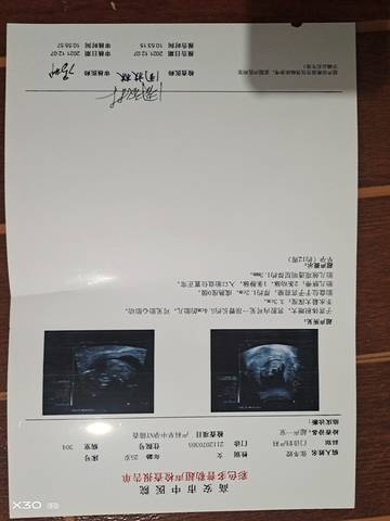 journal_insert_pic_1675606967