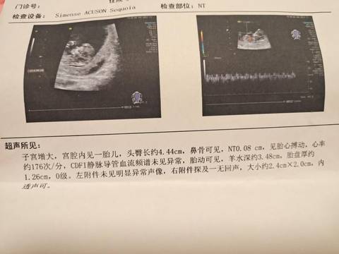 journal_insert_pic_1674013741