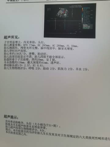 journal_insert_pic_1675052374