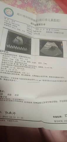 journal_insert_pic_1689824244