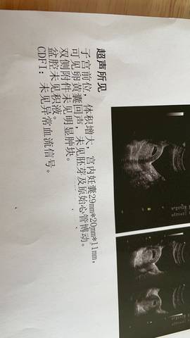 journal_insert_pic_1683677242