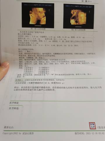 journal_insert_pic_1682196699