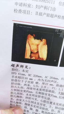 journal_insert_pic_1676914341