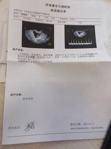 journal_insert_pic_1741151795