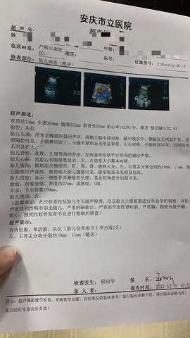 journal_insert_pic_1684249087