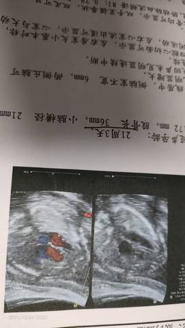 journal_insert_pic_1685576324