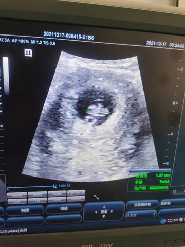 journal_insert_pic_1681544530