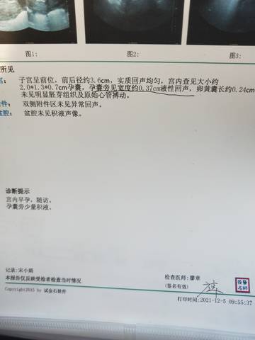 journal_insert_pic_1674003831