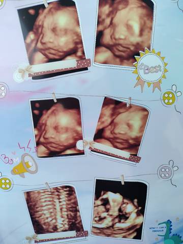 journal_insert_pic_1688337818