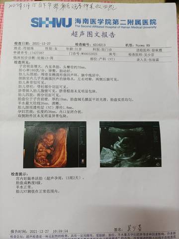 journal_insert_pic_1687487203