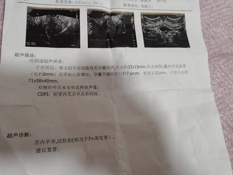 journal_insert_pic_1677679404