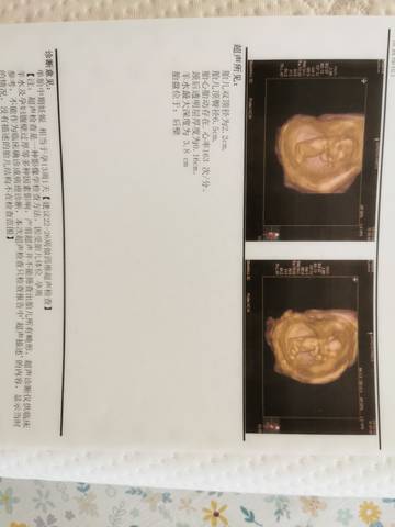 journal_insert_pic_1682687880