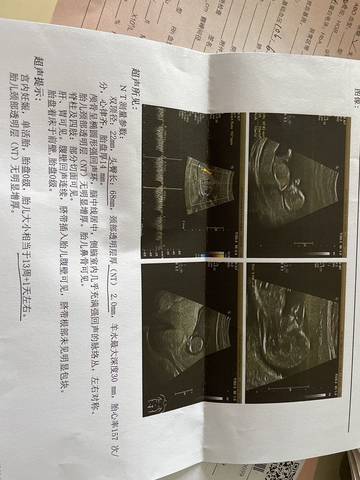 journal_insert_pic_1680987945