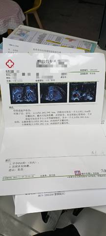 journal_insert_pic_1677495183