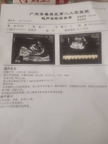 journal_insert_pic_1689430517