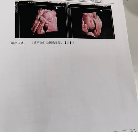journal_insert_pic_1689598410