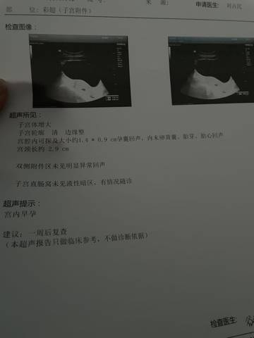 journal_insert_pic_1682070228