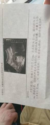 journal_insert_pic_1673884588