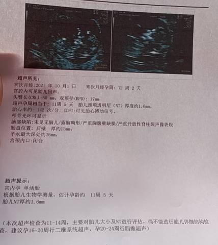 journal_insert_pic_1686448063