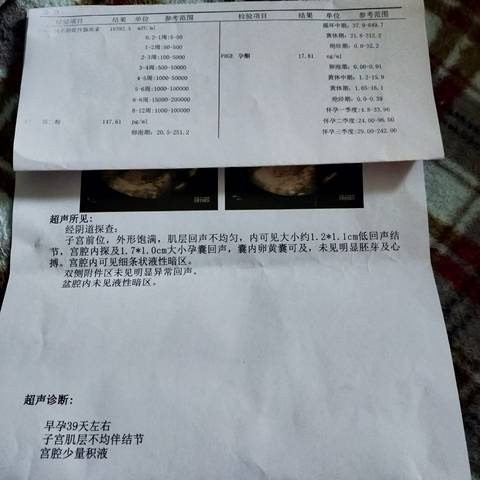 journal_insert_pic_1688372165