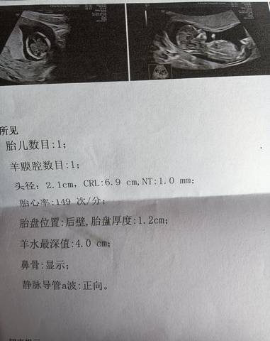 journal_insert_pic_1678196173