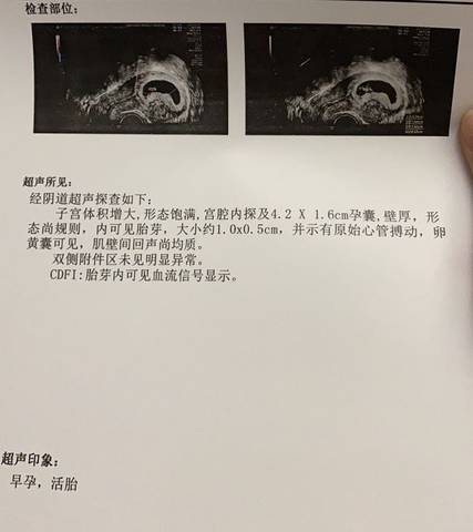 journal_insert_pic_1684193819