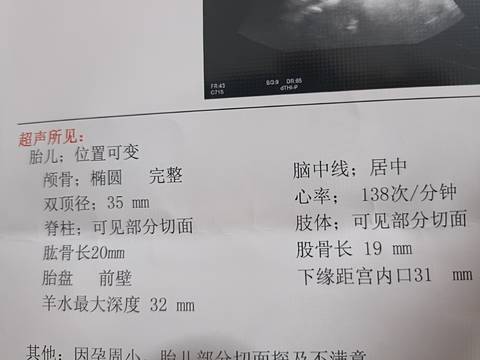 journal_insert_pic_1676337258
