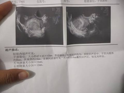 journal_insert_pic_1675603344