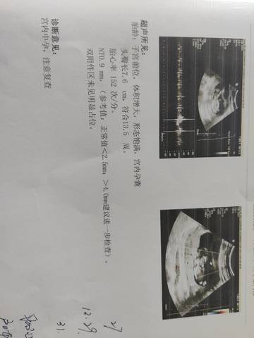 journal_insert_pic_1675605315