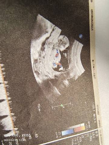 journal_insert_pic_1719926060