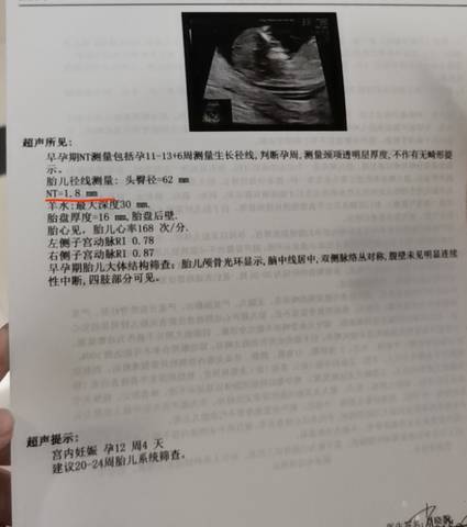 journal_insert_pic_1683180500