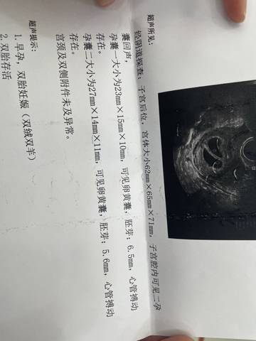 journal_insert_pic_1676317447