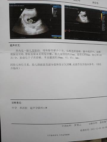 journal_insert_pic_1675035867