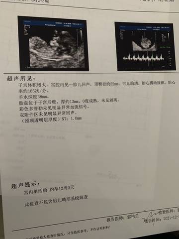 journal_insert_pic_1685803937