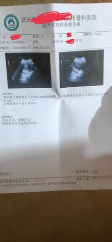 journal_insert_pic_1682966180