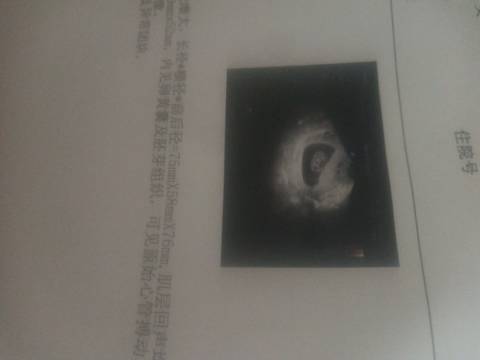 journal_insert_pic_1679389376