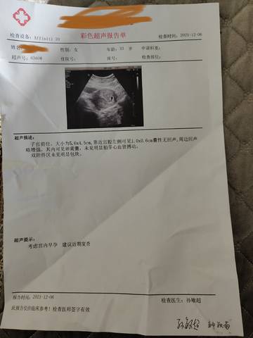 journal_insert_pic_1674731894