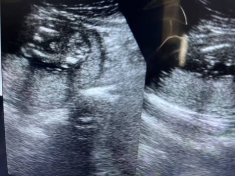 journal_insert_pic_1682162332